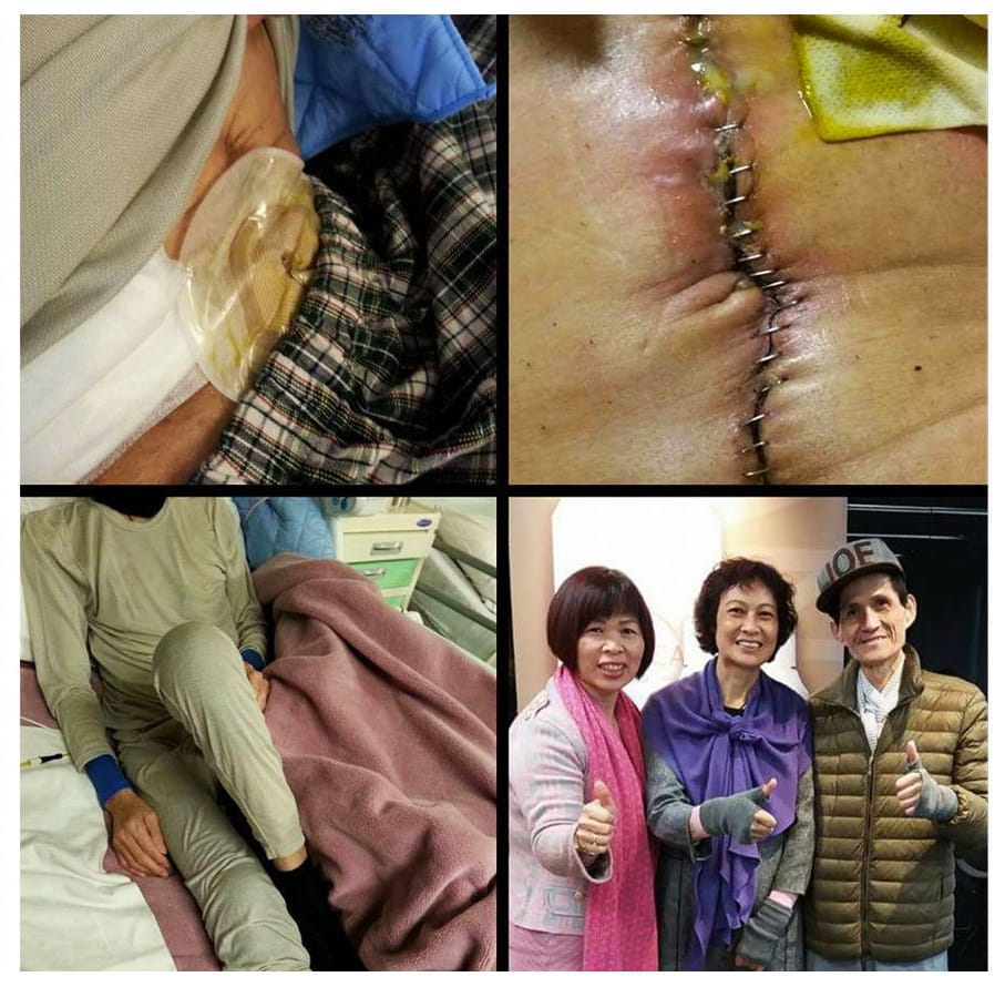 Testimonial for Colorectal Cancer & Wound Healing | Negative Ions Clothes