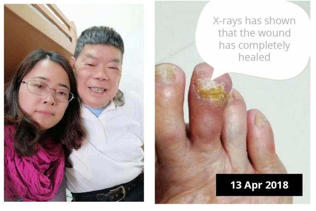 Testimonial for Diabetes | Negative Ions Clothes