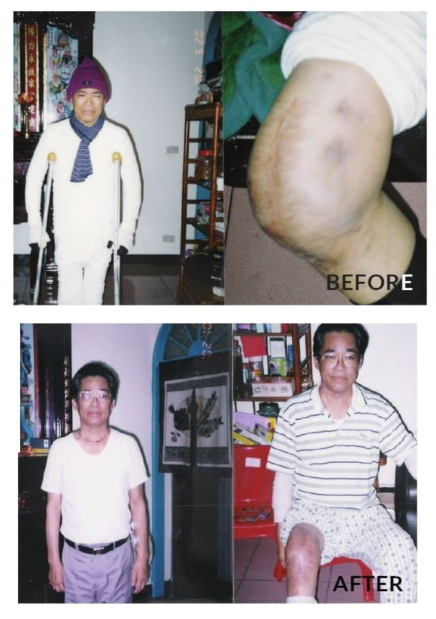 Testimonial for Diabetes | Negative Ions Clothes