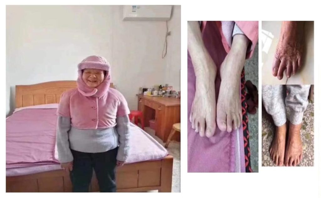 Testimonial for Diabetes and Angiomas | Negative Ions Clothes