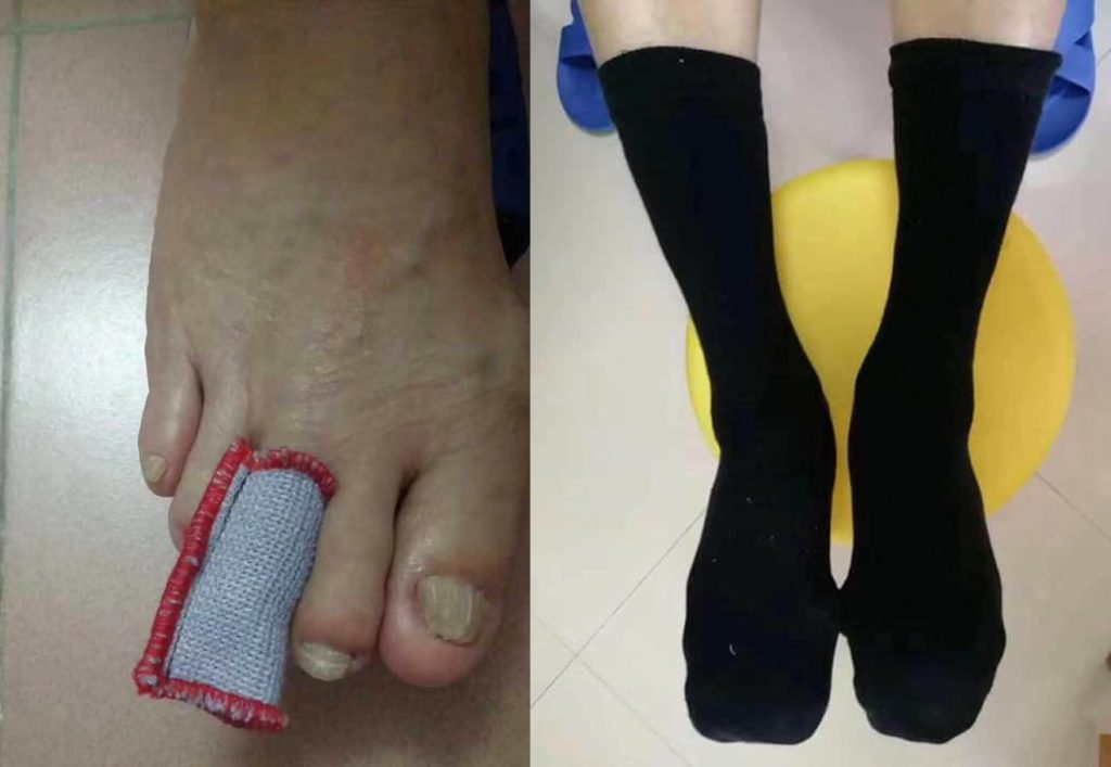 Testimonial for Diabetes - Sock | Negative Ions Clothes