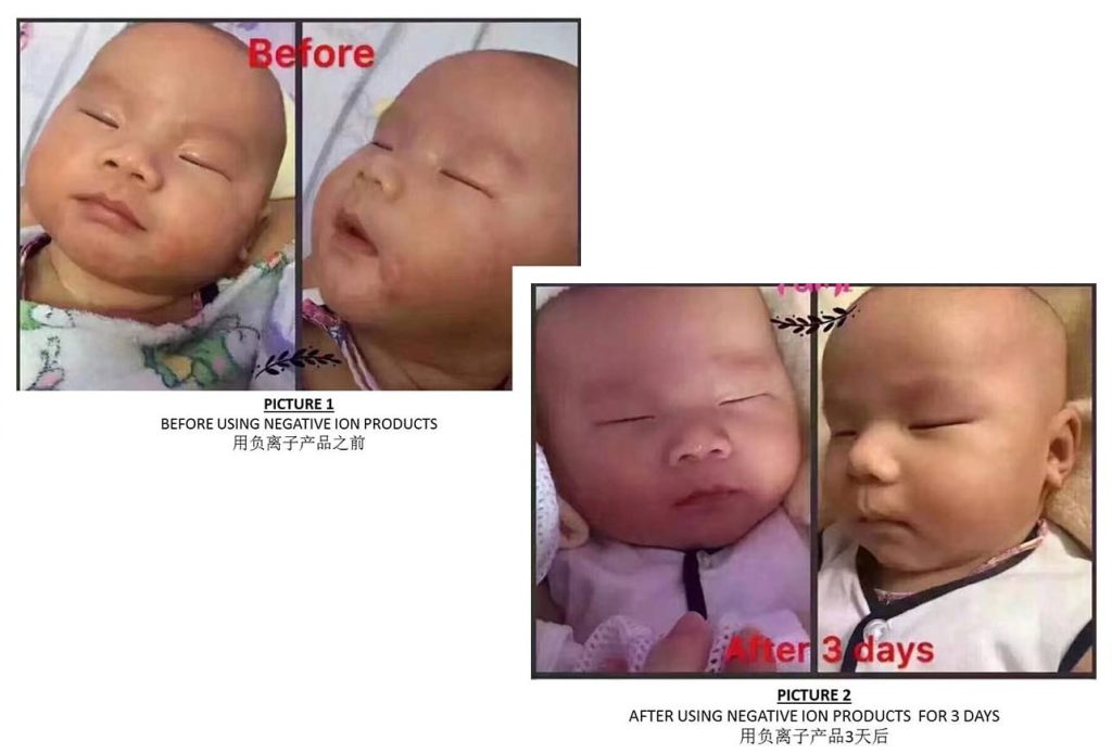 Testimonial for Sensitive Skin | Negative Ions Clothes