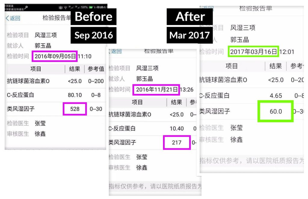 Testimonial for Severe Rheumatoid Arthritis | Negative Ions Clothes