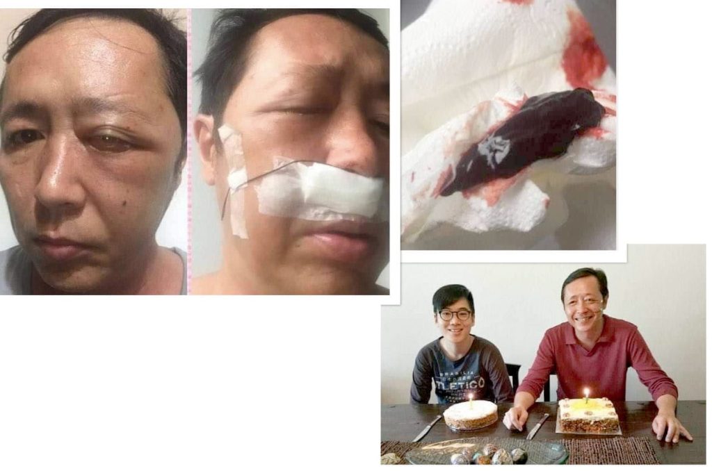 Testimonial for Sinus Cancer | Negative Ions Clothes