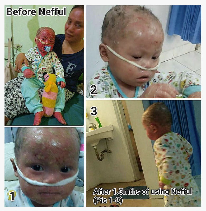 Testimonial for Skin Disease | Negative Ions Clothes