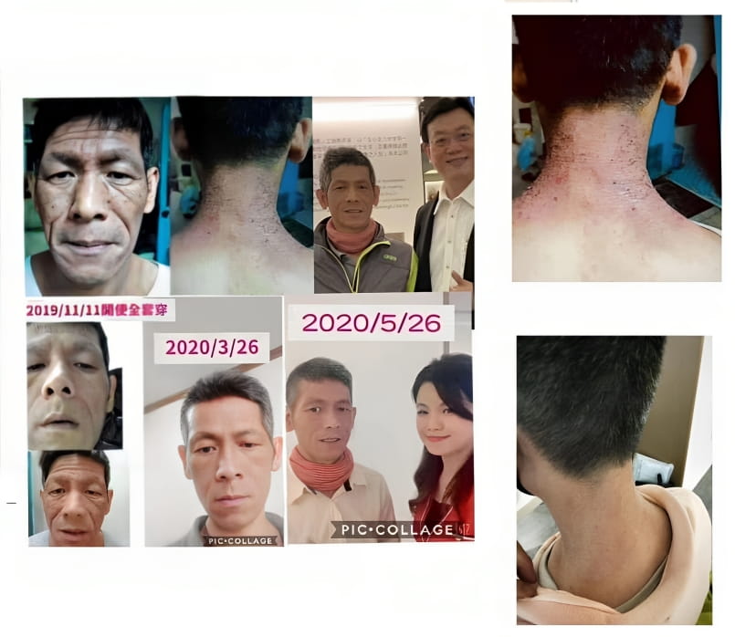 Testimonial for Skin Issues (Eczema, Rashes) | Negative Ions Clothes