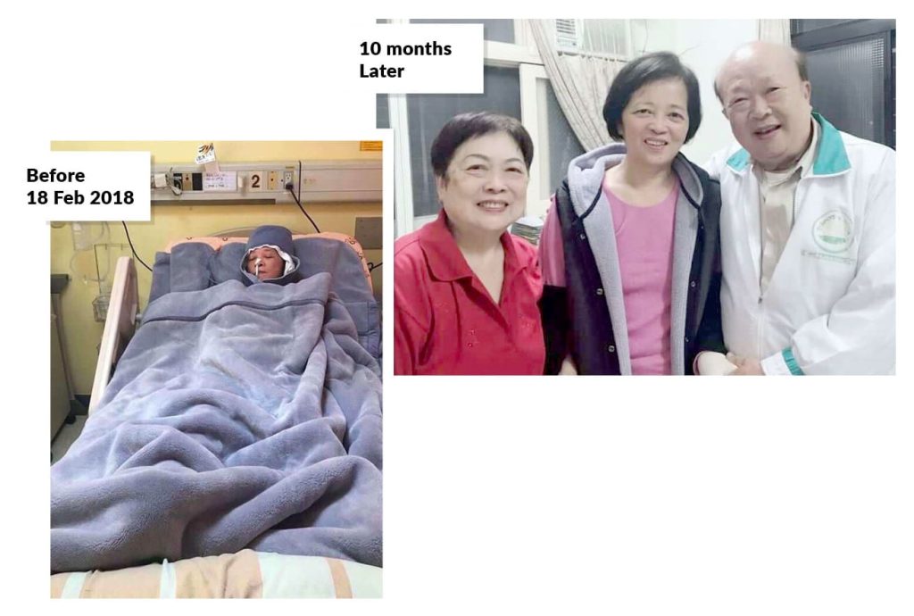 Testimonial for Stroke | Negative Ions Clothes