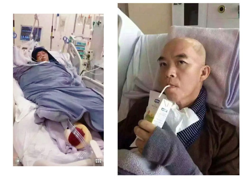 Testimonial for Stroke - Left Brain Hemorrhage | Negative Ions Clothes