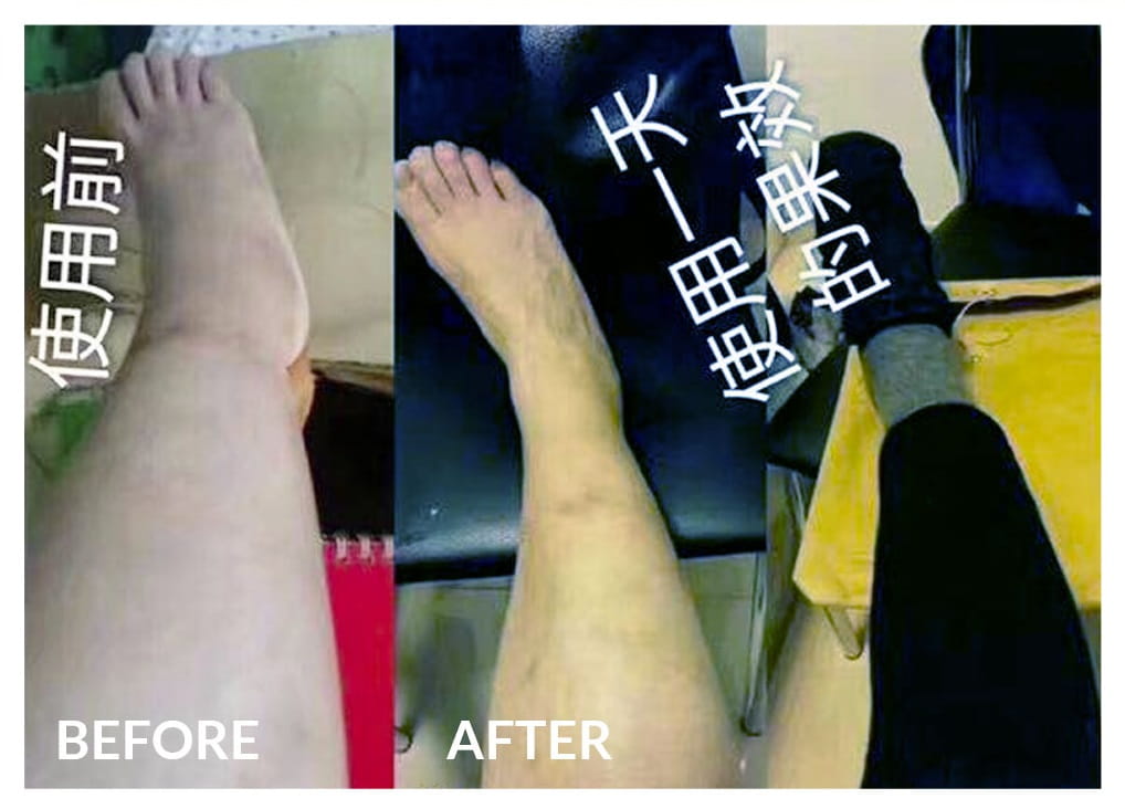 Testimonial for Gout, Stiff Knee, Feet Swelling | Negative Ions Clothes