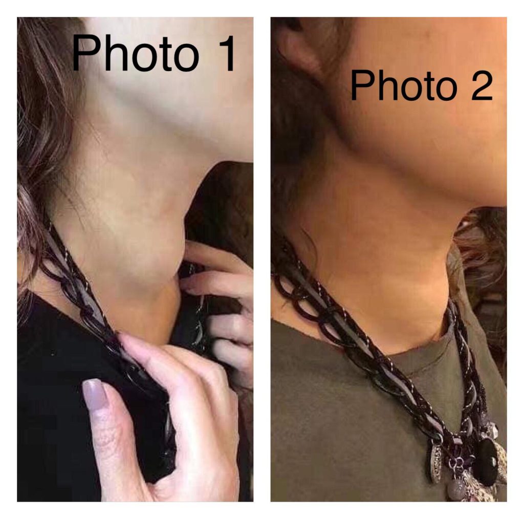 Testimonial for Thyroid Tumor | Negative Ions Clothes