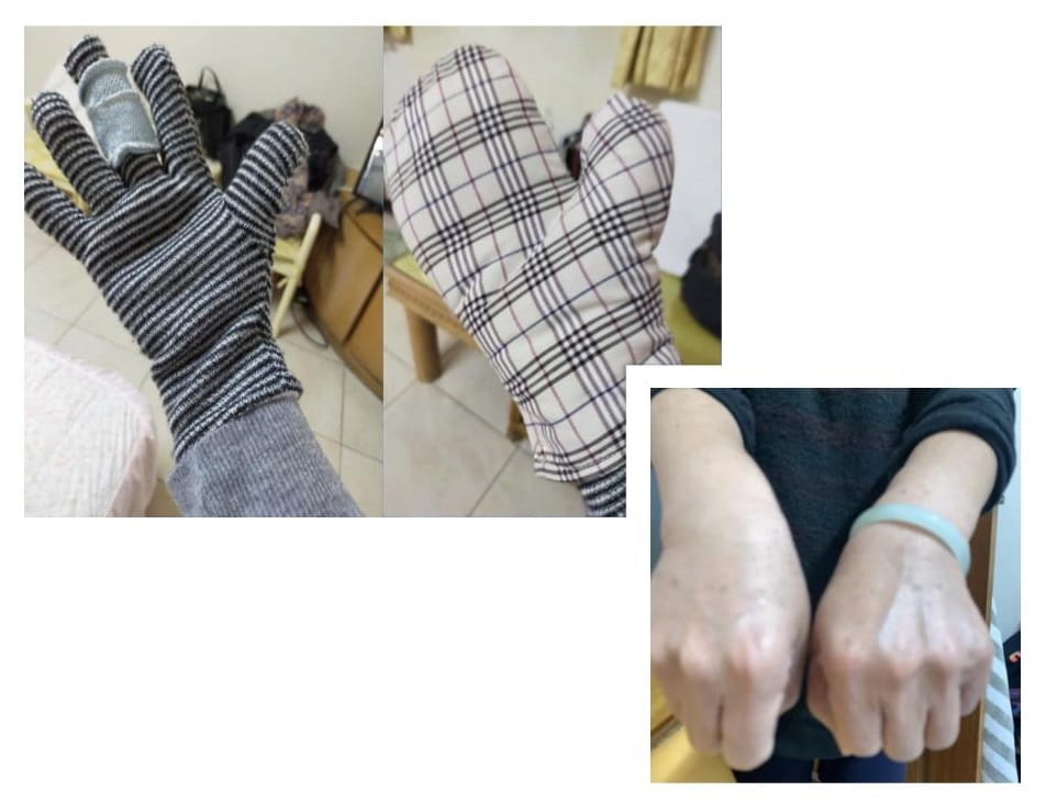 Testimonial for Trigger Finger | Negative Ions Clothes